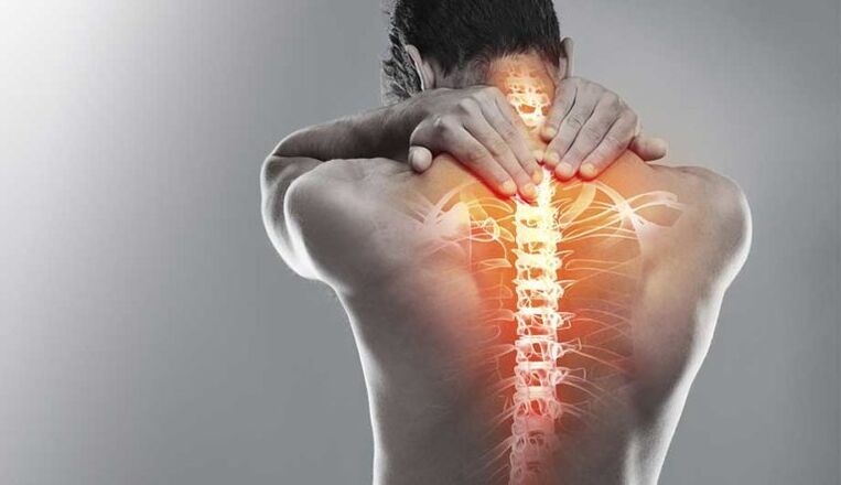 Тешка болка во средината на грбот - знак за оштетување на 'рбетот