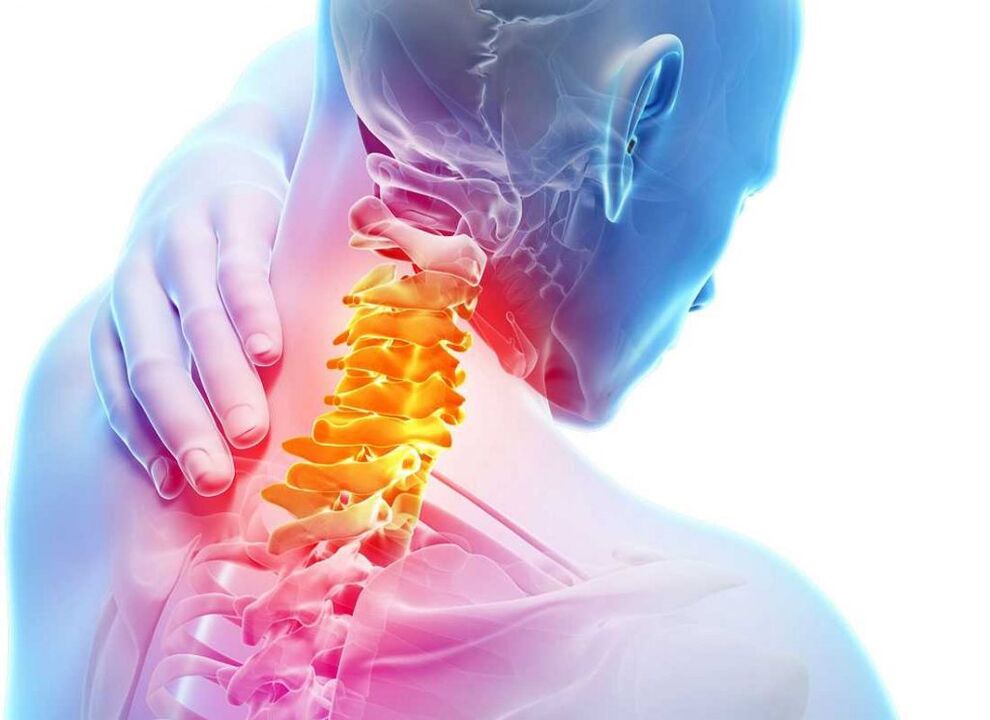 болка во цервикалниот 'рбет со остеохондроза