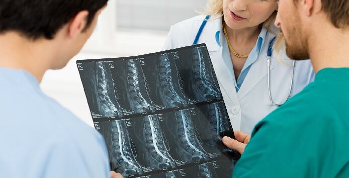Х-зраци на 'рбетот како начин за дијагностицирање на остеохондроза
