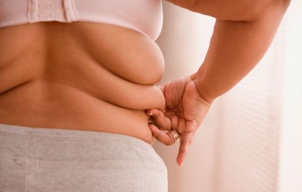 прекумерна тежина, причина за цервикална остеохондроза кај жени под 40 години
