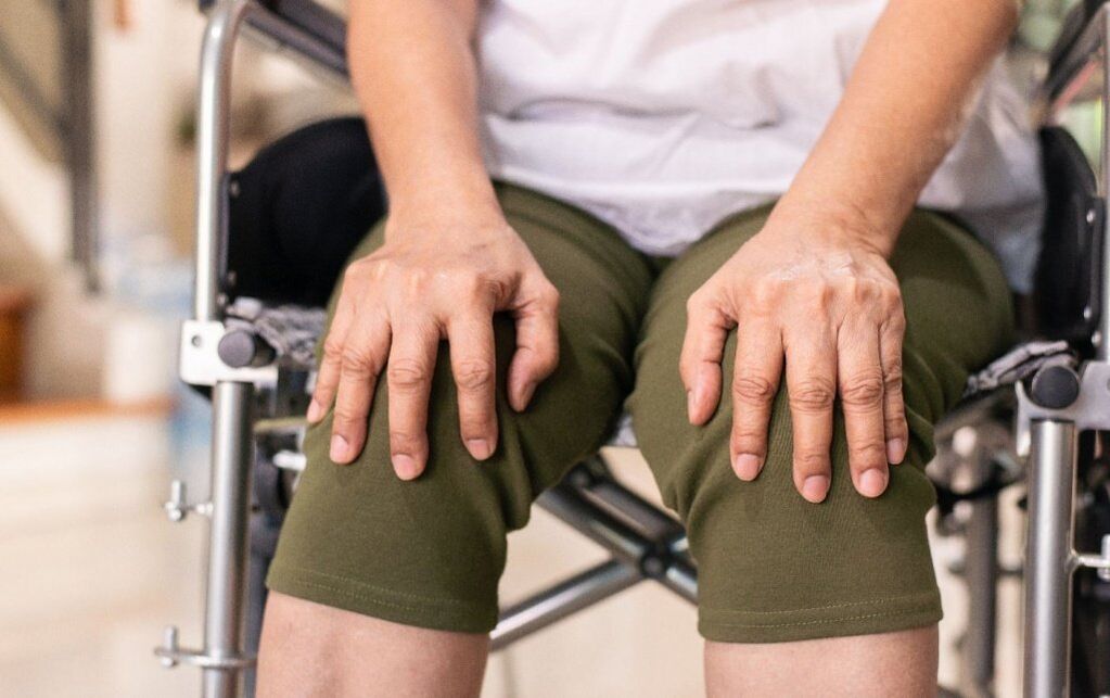 Пациент со артроза на колена зглобовите