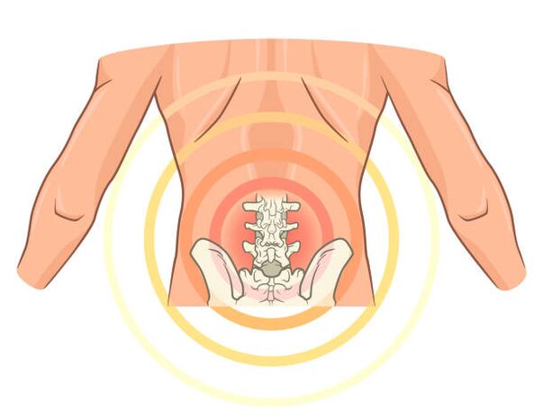 остеохондроза на лумбалниот 'рбет